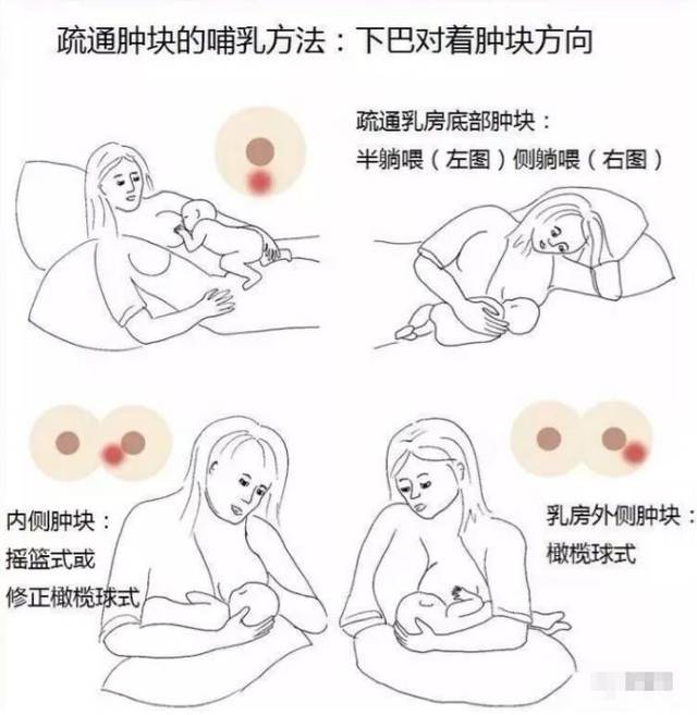 產(chǎn)后漲奶，疼痛難忍怎么辦？