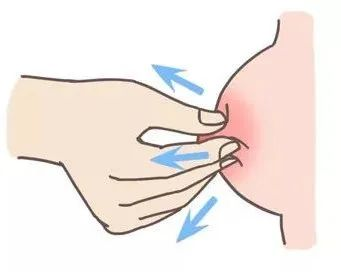 大乳頭、小乳頭、扁平乳頭、凹陷乳頭3大喂養(yǎng)指導(dǎo)及護(hù)理指南！