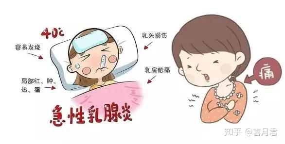 乳腺炎反復(fù)發(fā)作？這6個方法很管用