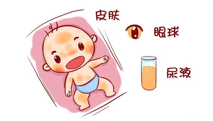 新生兒出生沒黃疸，大多是孕媽在孕期做了3件事