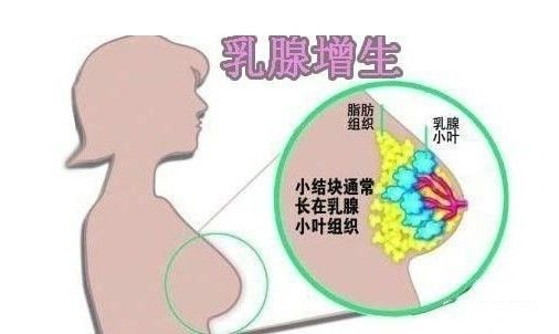 乳房出現(xiàn)“青筋”是什么原因呢？