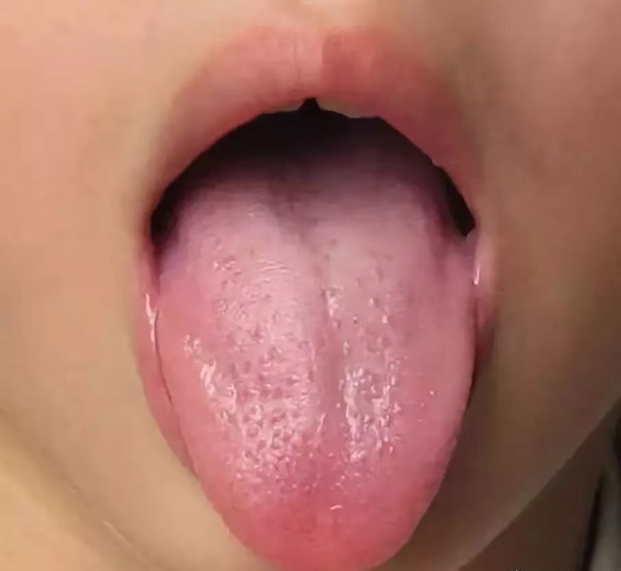 過度喂養(yǎng)危害大，寶寶發(fā)出的積食信號(hào)你能看懂多少？