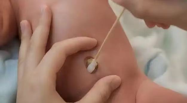  肚臍眼里的污垢，到底能不能摳？ 