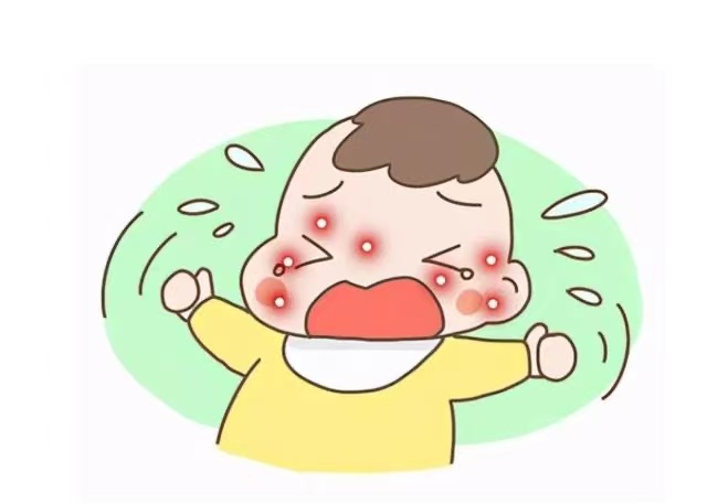 孩子濕疹反復(fù)發(fā)作怎么辦？這些防治方法請(qǐng)收好！